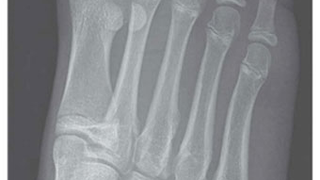 From Wiiitis to Wii Fractures: A Guide to Nintendoid Medical Conditions